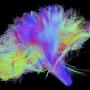 Утопия мозга – 2054: сверхчеловеческие возможности нейробиологии