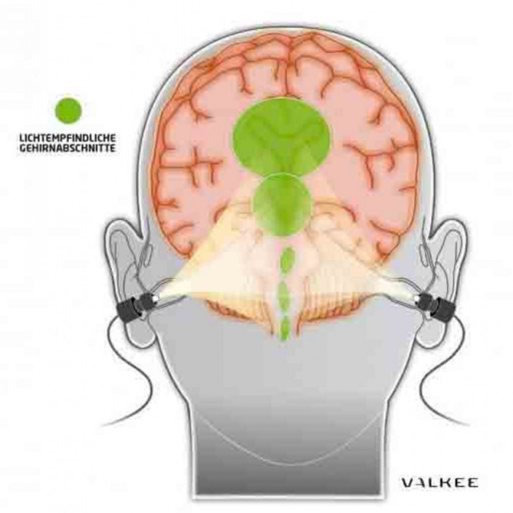 Мозг через рот. Мозг с ушами. Мозг в наушниках. Влияние наушников на слух человека.