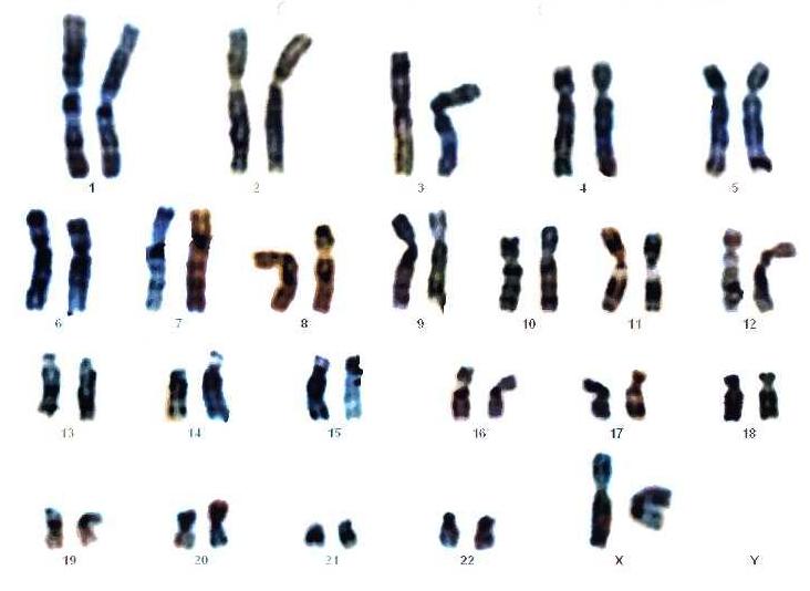 Женский набор хромосом