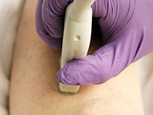 Ультразвук изменит операции по пересадке кожи, доказали тесты