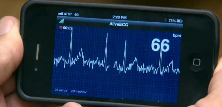 Приложение AliveCor демонстрирует ЭКГ на экране смартфона (кадр из демо-ролика)
